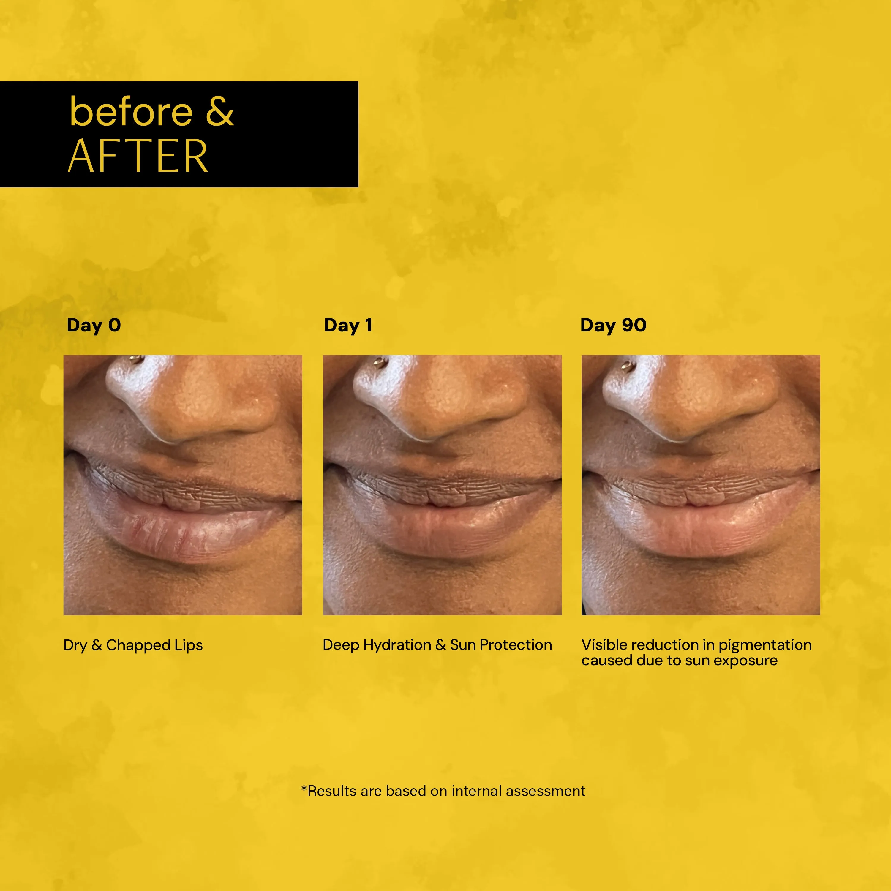 Brightening Lip Balm with SPF 30 - 1% Vitamin C   0.1% Resorcinol