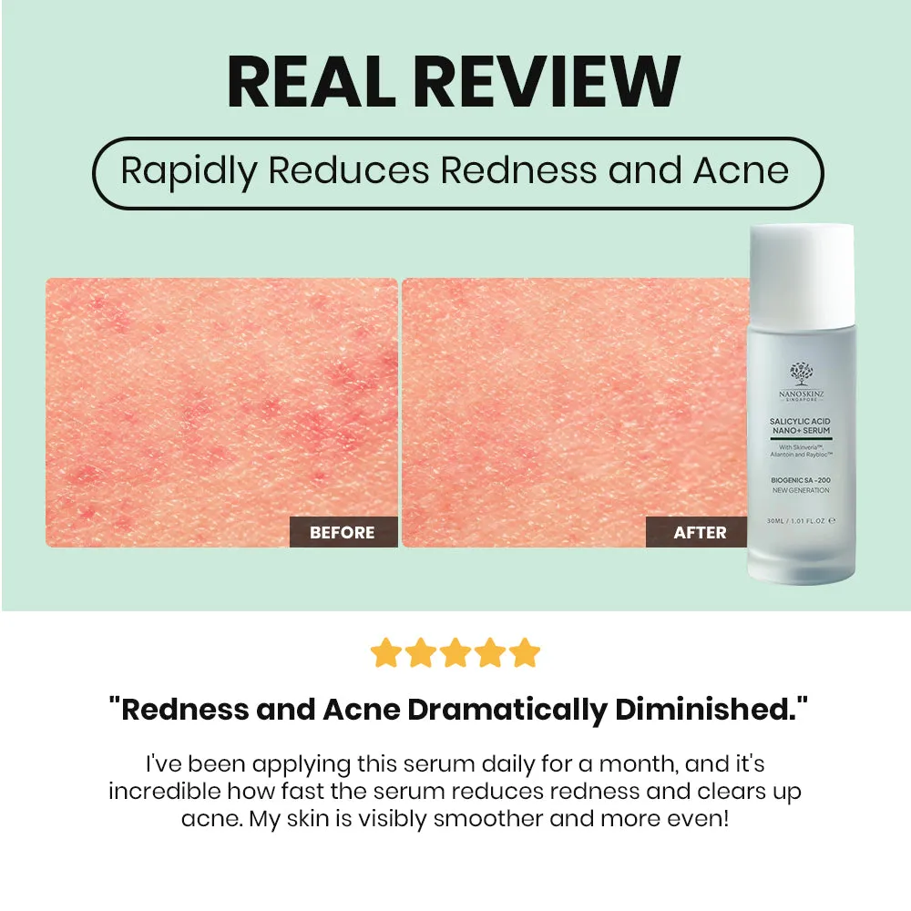 Nano Skinz Salicylic Acid Serum - 30ml
